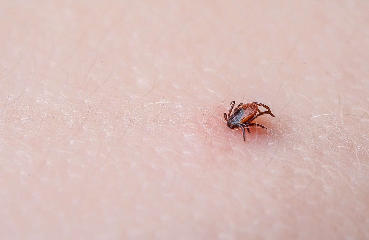 How to be tick aware